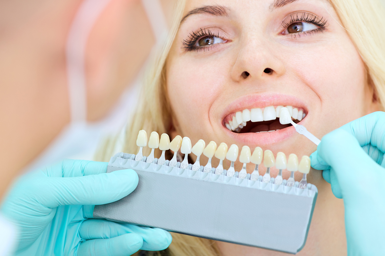 Remplacement dents manquantes dentier